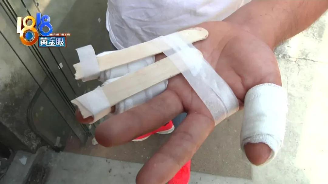 钢化玻璃爆裂会不会伤到人,钢化玻璃爆裂有碎渣掉落吗