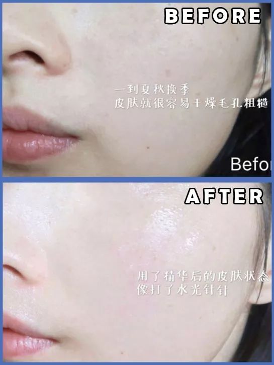 熬最深的夜,也要发最亮的光!烟酰胺精华,让你熬夜也有少女颜