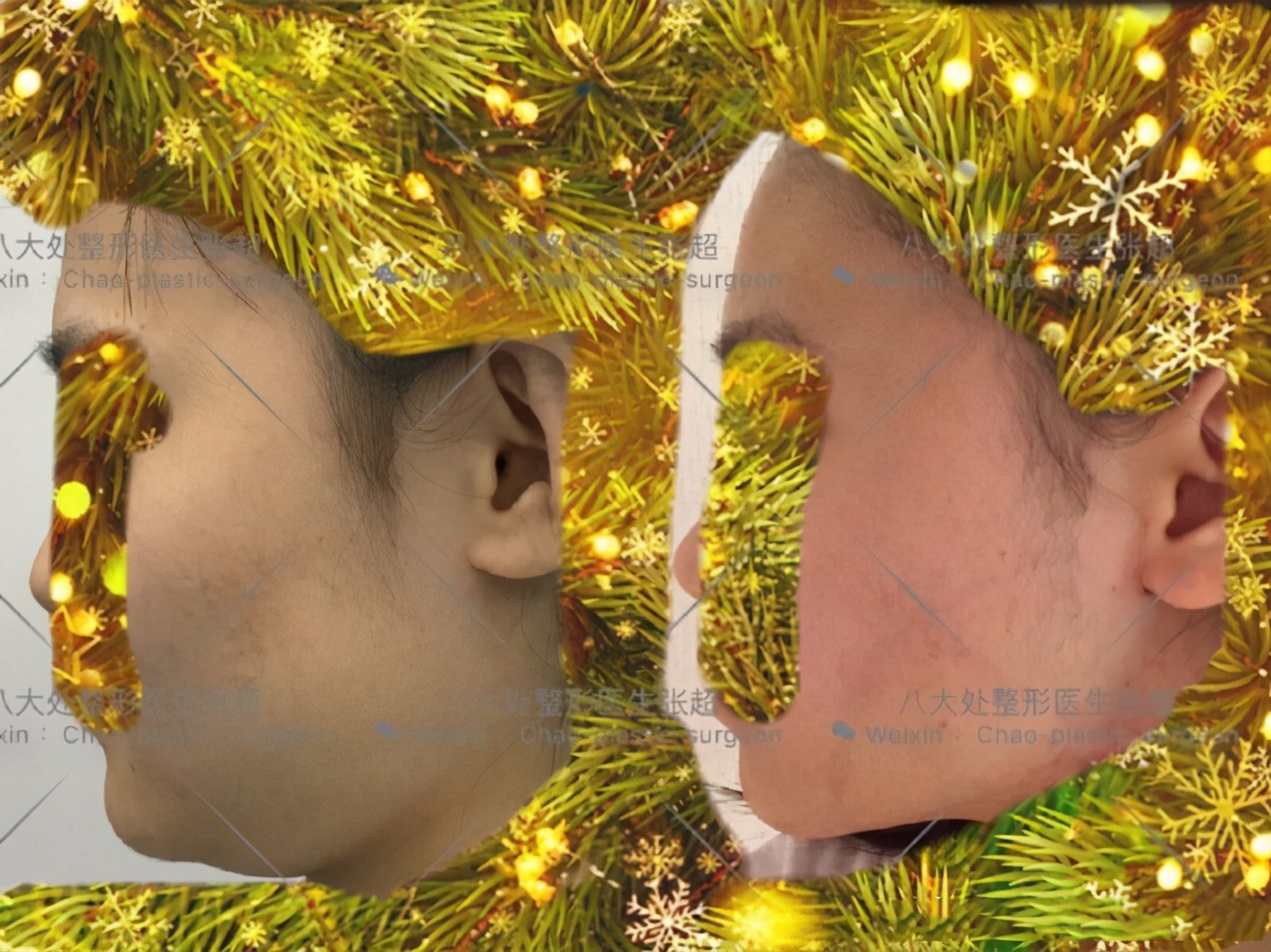 八大处整形张超,八大处张超最新视频