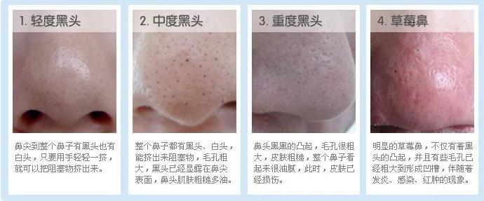 雅诗兰黛基础护肤,日常基础护肤视频