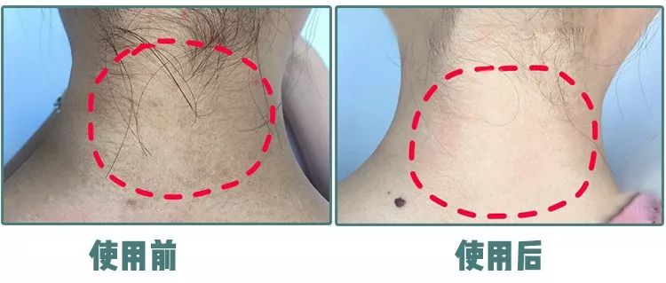 张韶涵护肤三周养皮,燕窝水漾嫩肤精华面膜包文婧