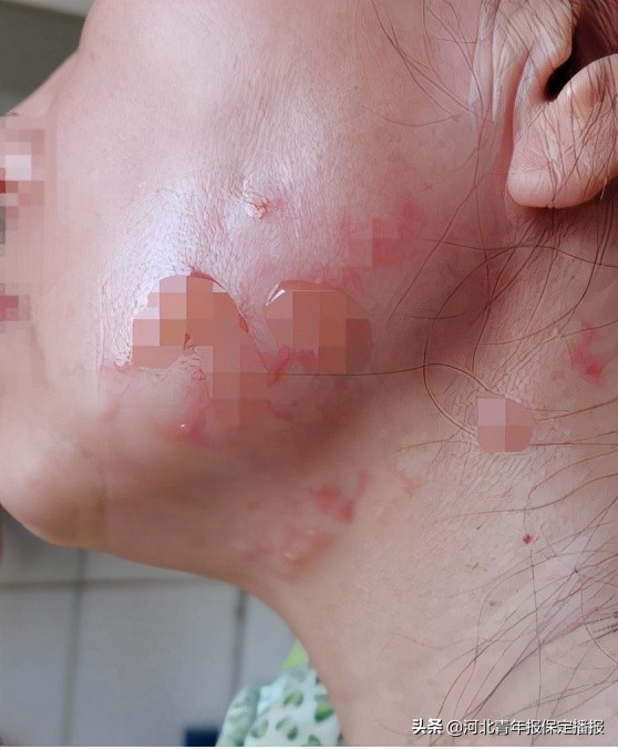 河北保定热玛吉,保定热玛吉事件