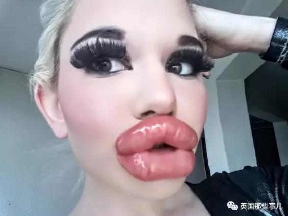 20次丰唇,20次整容成功的女人