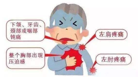 胸痛未必都是冠心病，但是同样不能耽搁