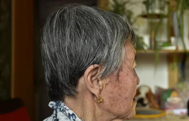 为什么有人长老年斑有人不长,为啥有人长老年斑有人不长