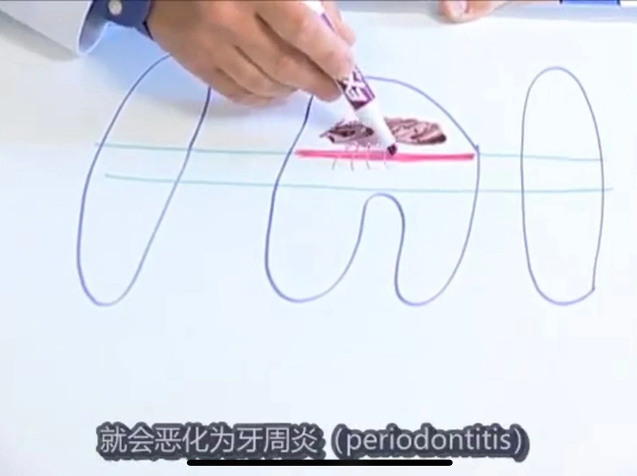 猫有牙周炎该怎么治疗,猫有牙龈炎怎么治疗