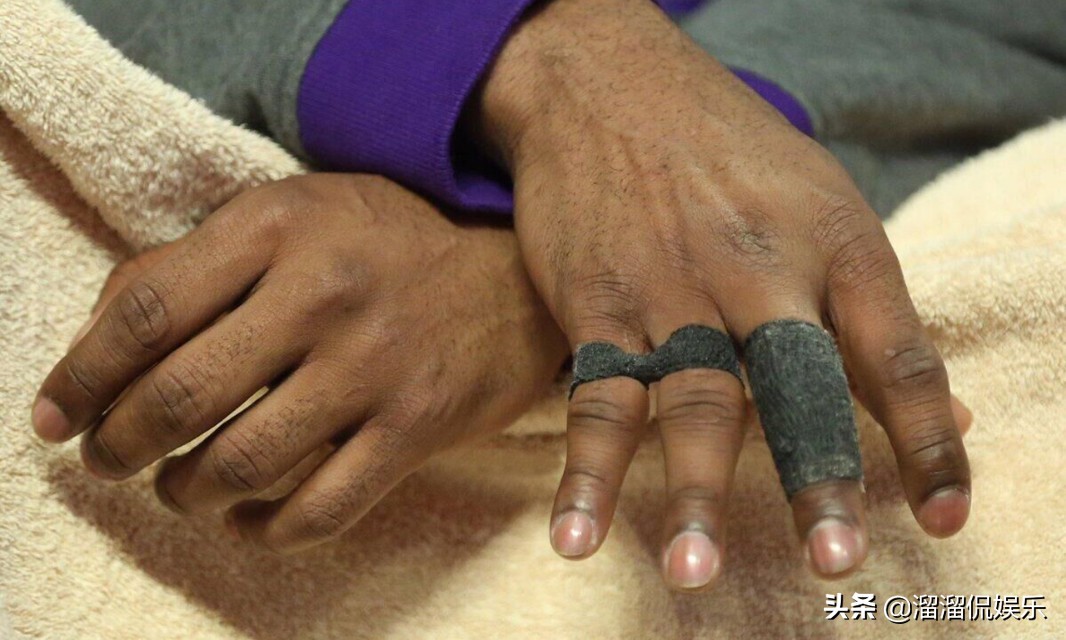 詹姆斯脚趾严重变形图片,詹姆斯脚趾受伤