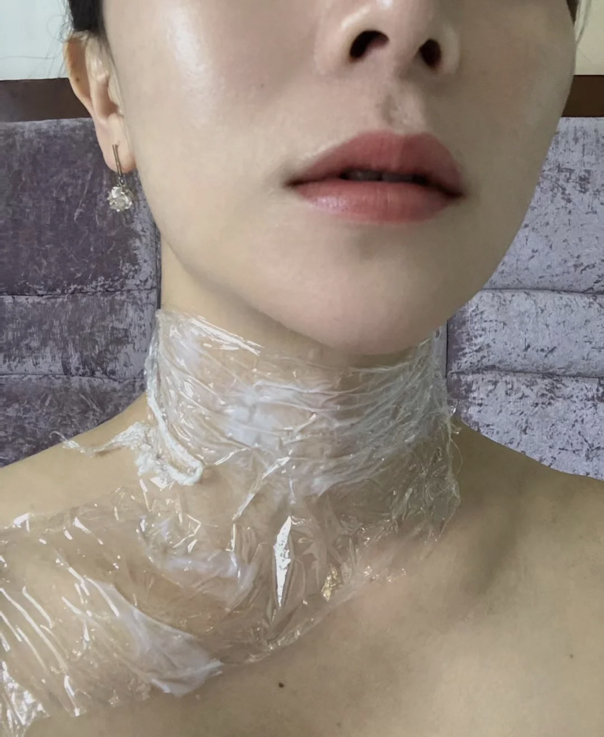 有很深颈纹的女生怎么改善,颈纹难看显老如何改善