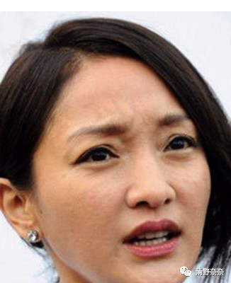 解决眼部干纹黑眼圈最好的方法,黑眼圈眼袋干纹怎么消除