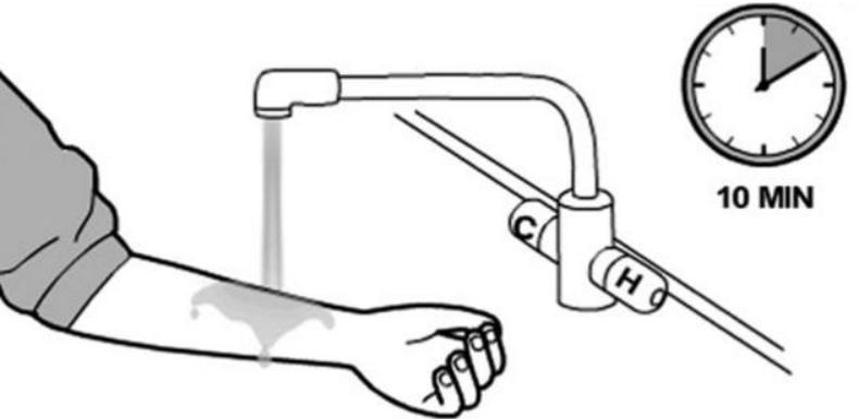 孩子被烫伤后，要先冲水还是先脱衣服？第一步做错，会加重伤情