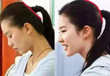 老人睡扁头是怎么回事,为什么老人非要给孩子睡扁头