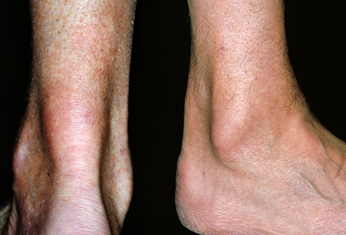 身体有病胯骨先知,身体有病双腿先知