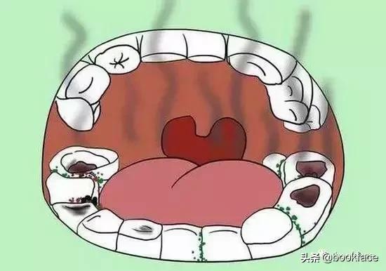 会传染的口臭属于什么口臭,女友嫌你口臭是怎么回事