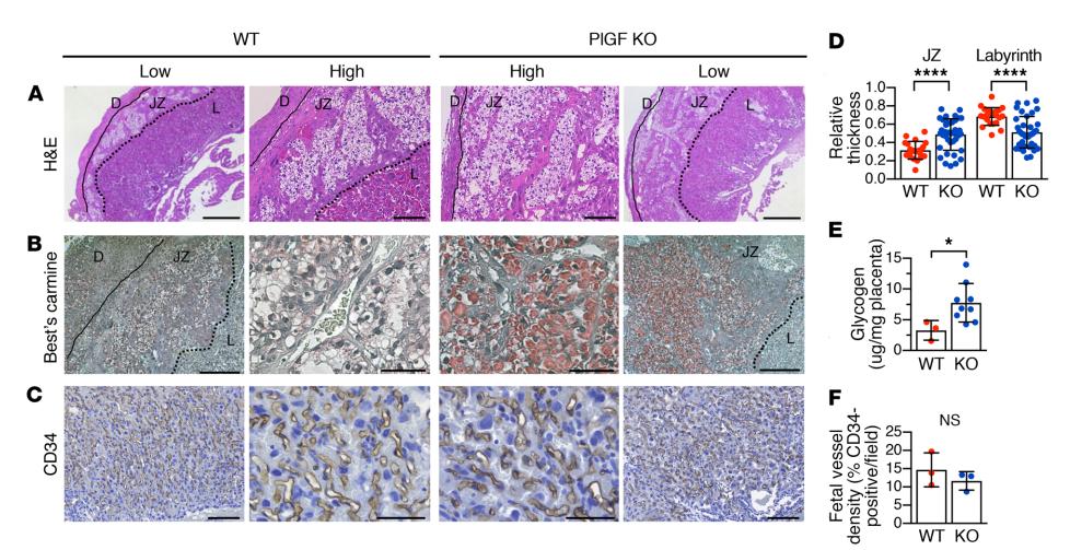 美国癌症中心：阻断胎盘生长因子能够改善妊娠高血压和先兆子痫