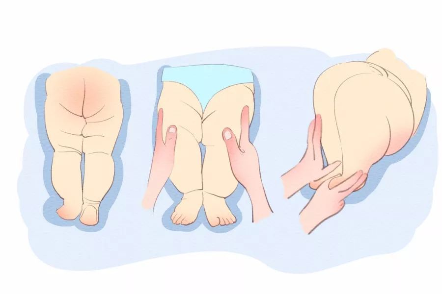 急死了！！宝宝的腿有点弯？到底是不是罗圈腿？