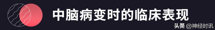 急性脑血管病的解剖诊断,脑的血液供应来源及脑血管的特点