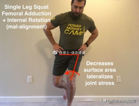 运动康复膝关节疼痛解决,下髌骨关节疼痛综合征