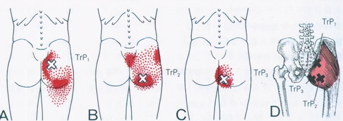久坐之后感觉腰不舒服怎么缓解,久坐后腰部隐隐作痛