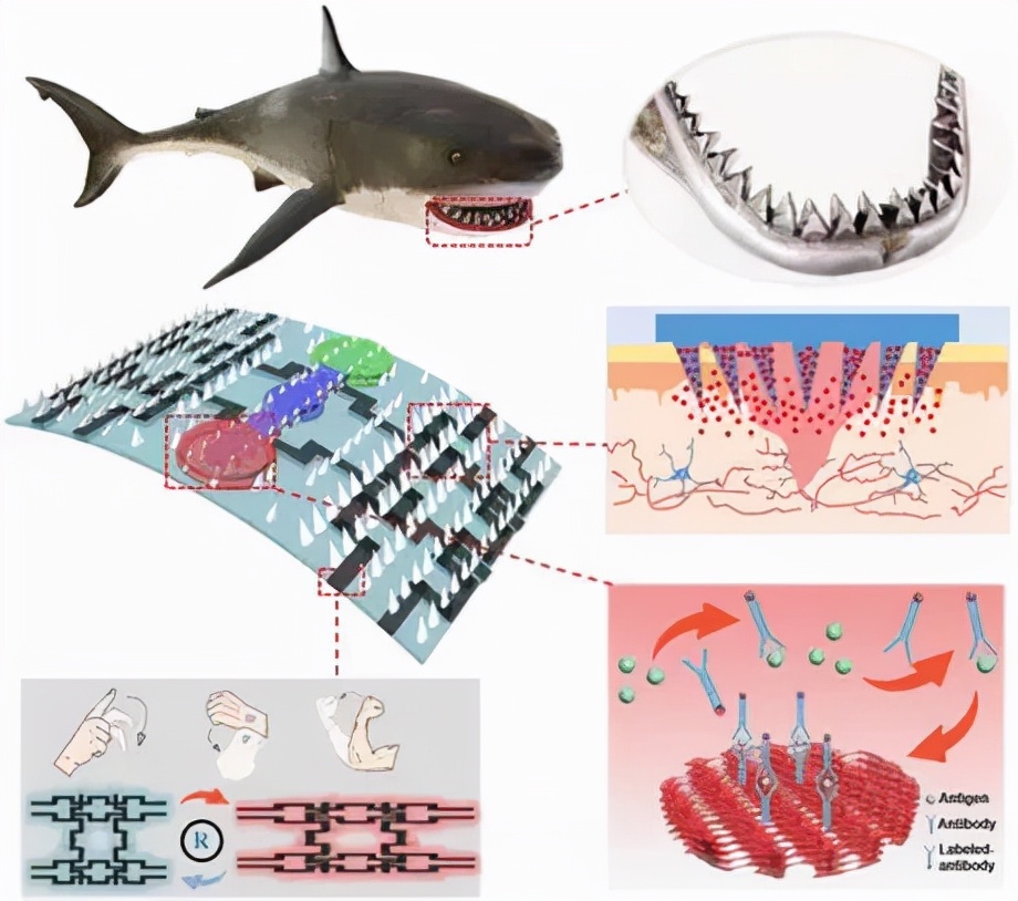 南京工业大学:一种可实现伤口智能管理的微针敷料