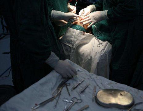 女人切除卵巢和正常人区别,女人切掉子宫和正常人有什么区别