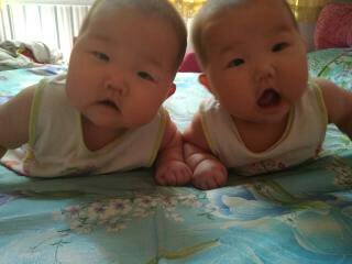 新生儿黄疸正常值对照表,新生儿黄疸值对照表1到30天