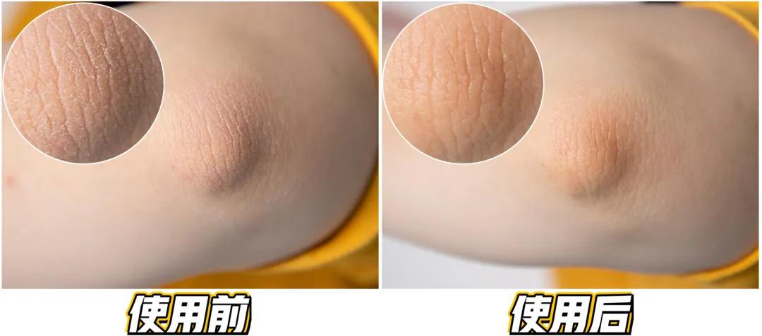 小米生态进军“搓澡业”?电动“小手”自动搓泥,不费力身体变白