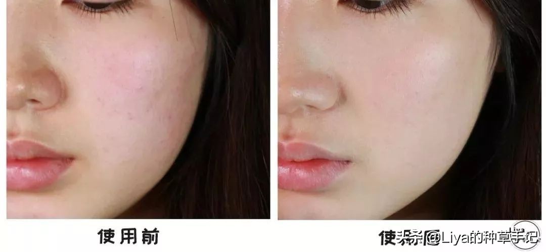 这款洗面奶​居然被点名了，你在用吗？