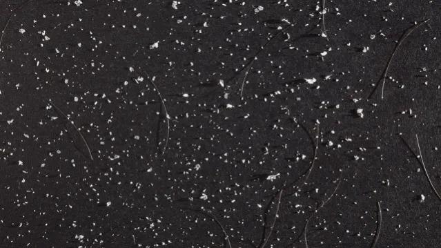 冬天腿上起白皮屑是怎么回事,冬天裤子上很多白色皮屑怎么去除