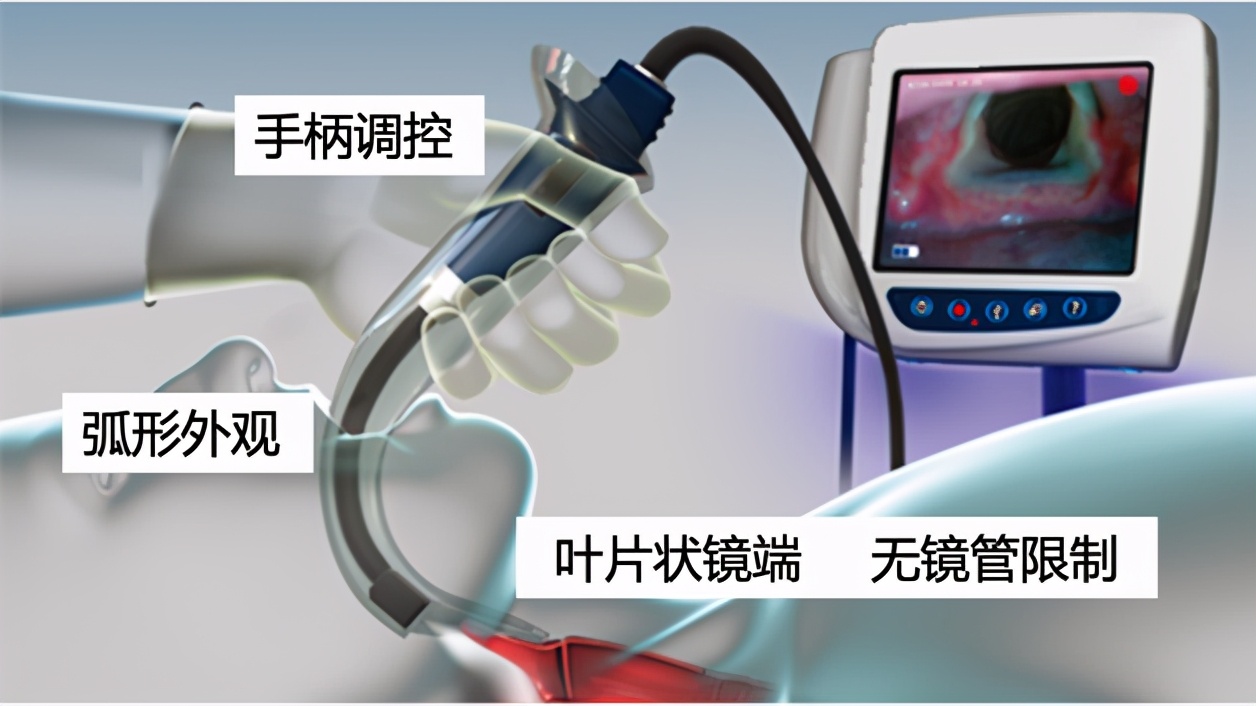 2020三院新技术|“弧”里乾坤——快速安全切除下咽肿物的新技术