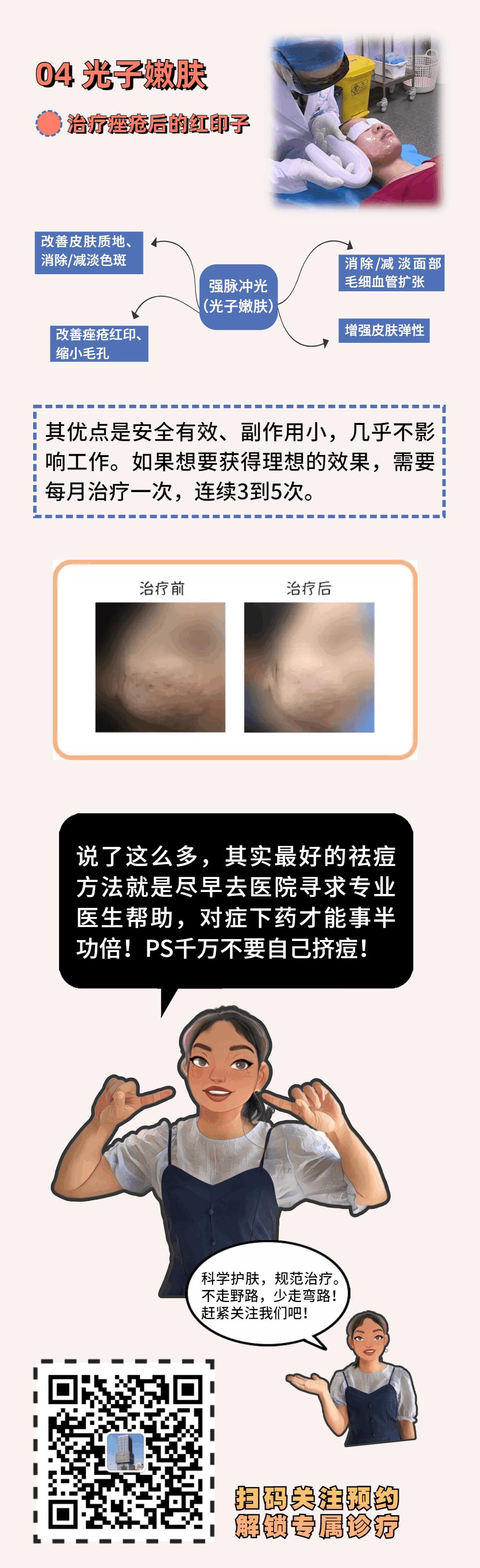 这些小技巧对付痘痘绰绰有余,怎样和青春痘说拜拜