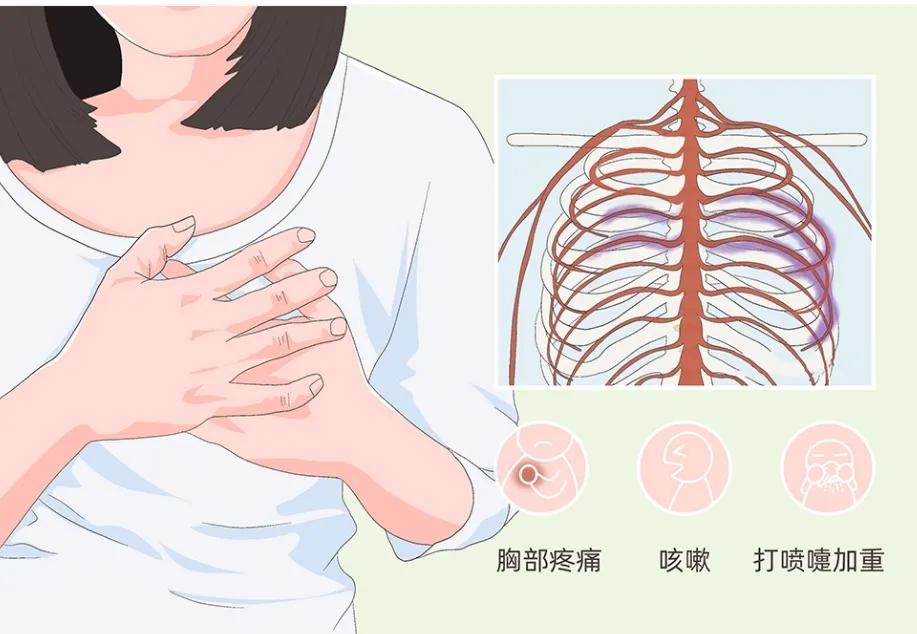 肋间神经痛多久自愈,肋间神经痛看哪个科