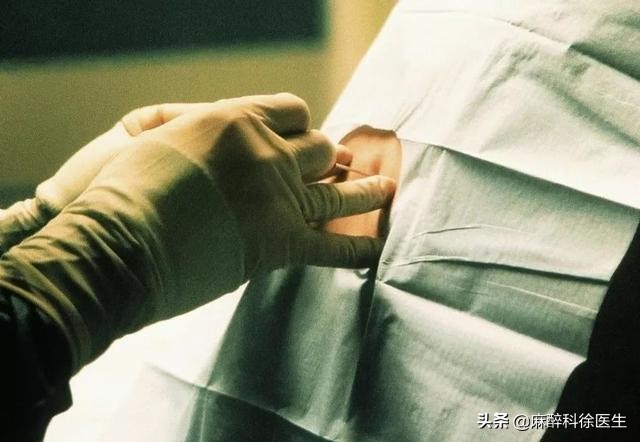 麻醉就是麻醉什么感觉,麻醉师讲的是什么