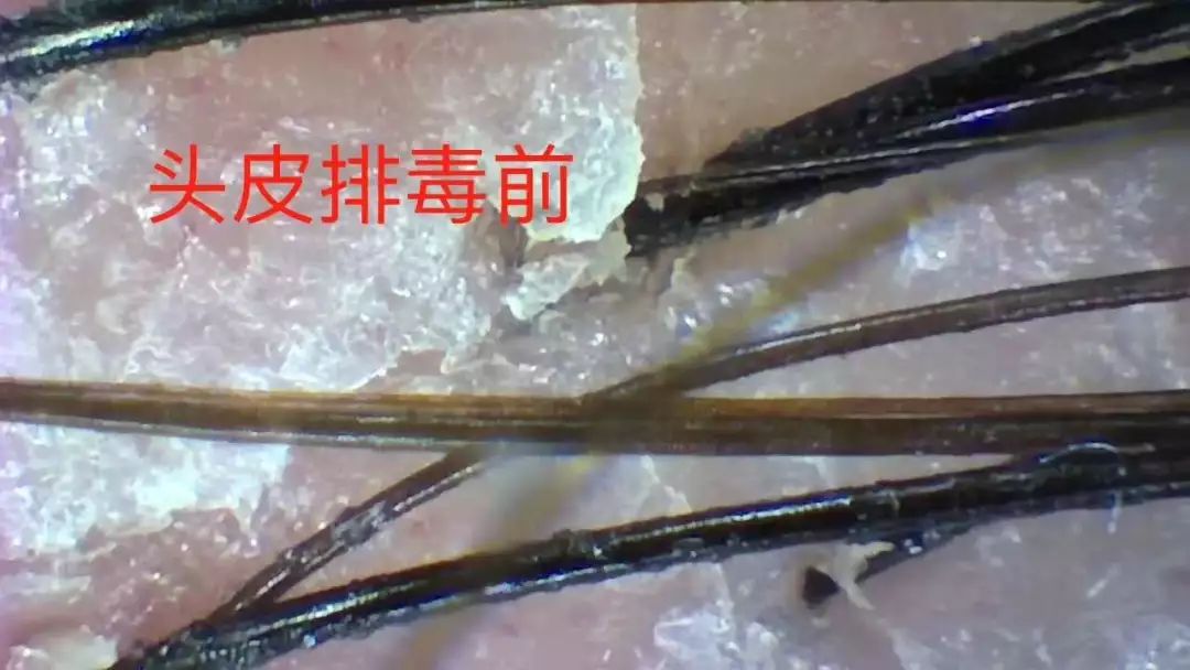 佳人神草侧柏广东广州,生发液评测