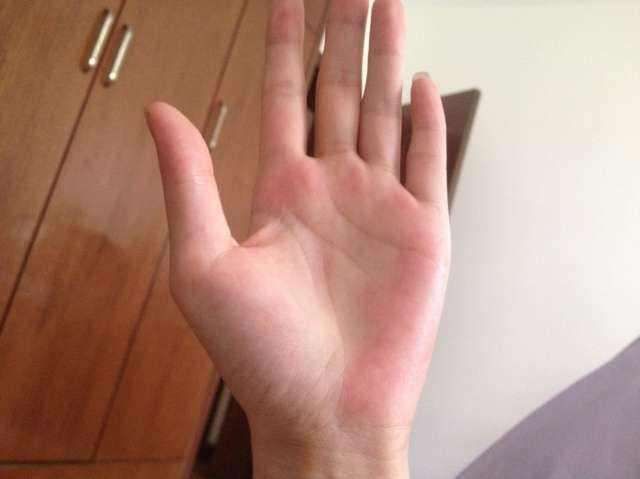 肝毒堆积在身体怎么调理,肝毒长期堆积会咋样