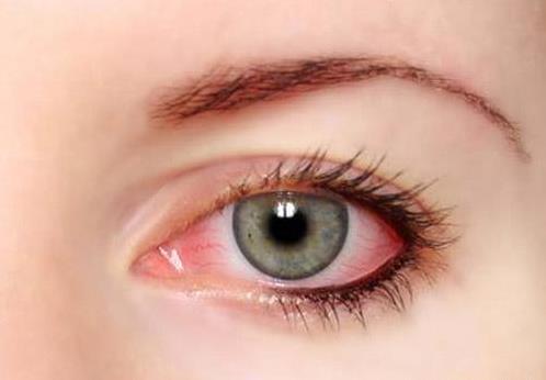 隐形眼镜没有异物但是带上不舒服,为什么隐形眼镜戴上去模糊不清