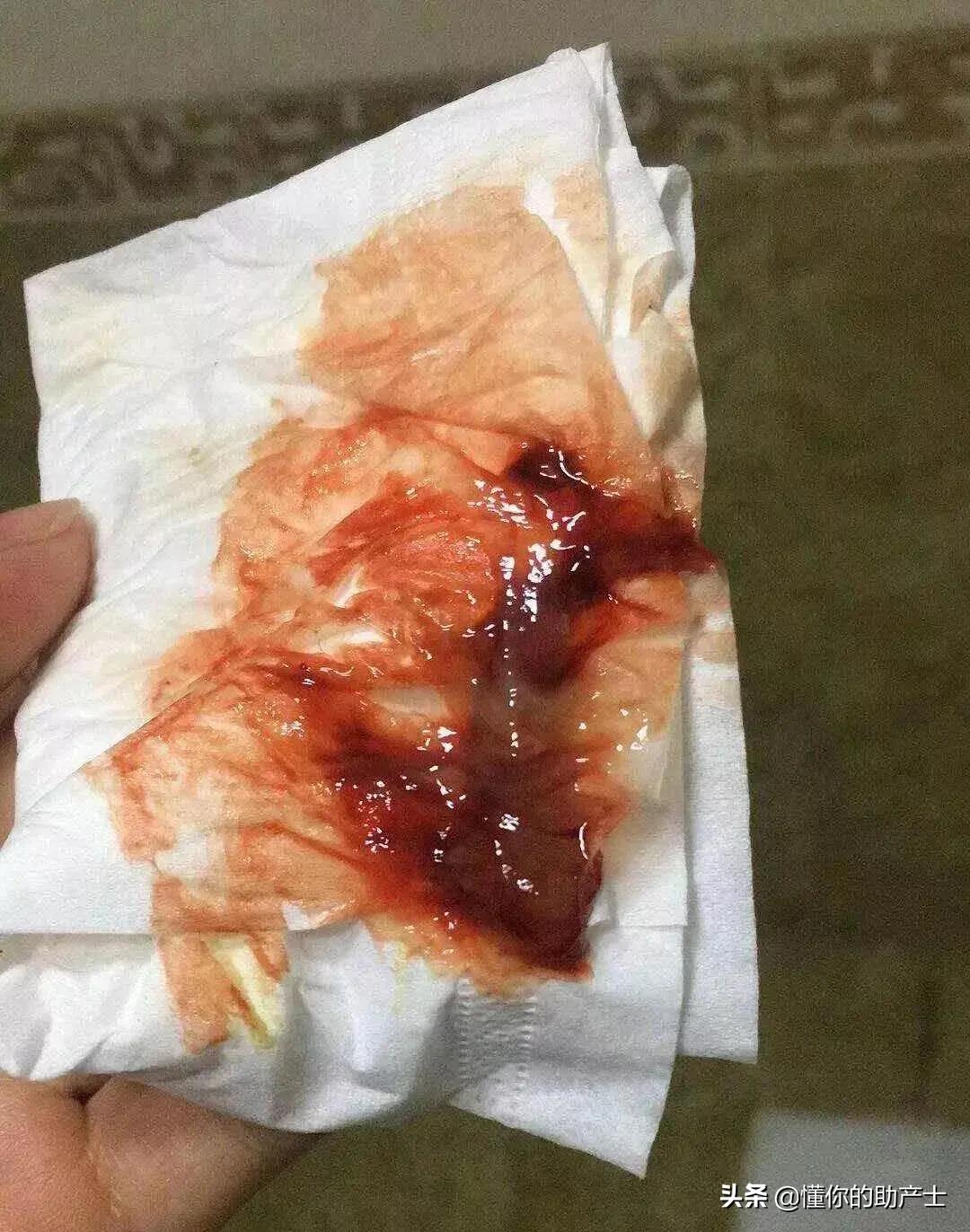 孕妇见红到最后的过程,怀孕见红是什么原理