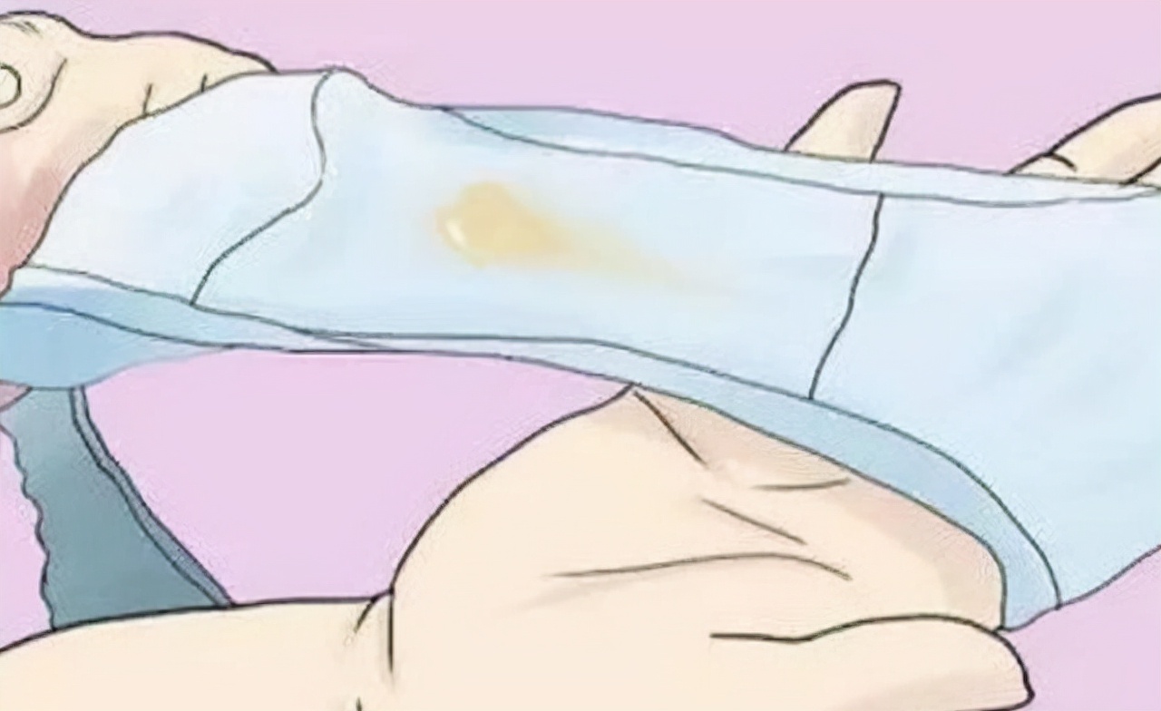 为啥女性*裤内**上，总有黄色分泌物，是什么原因呢？