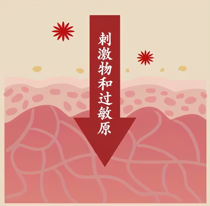 肛门湿疹反复痒,需要祛湿还是保湿,传染吗?