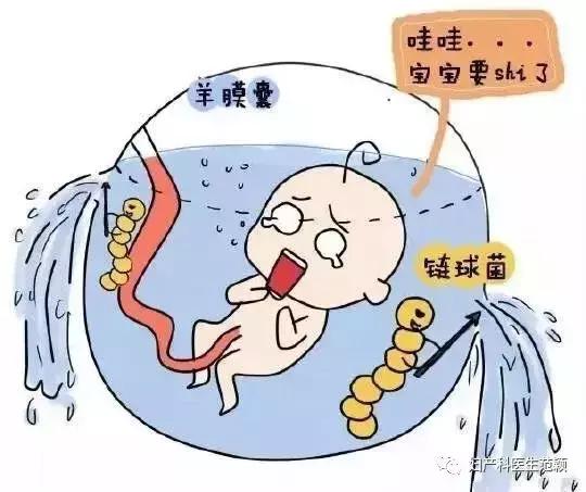 怀孕生娃那些事儿之胎膜早破