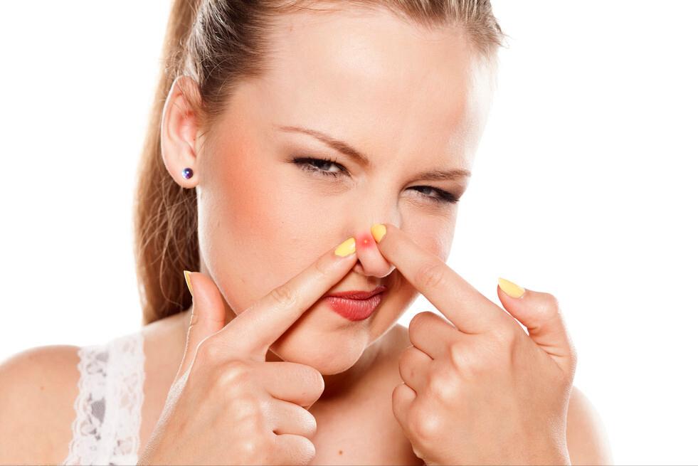 鼻子黑头白头怎么去除最有效,鼻子黑头白头怎么去除