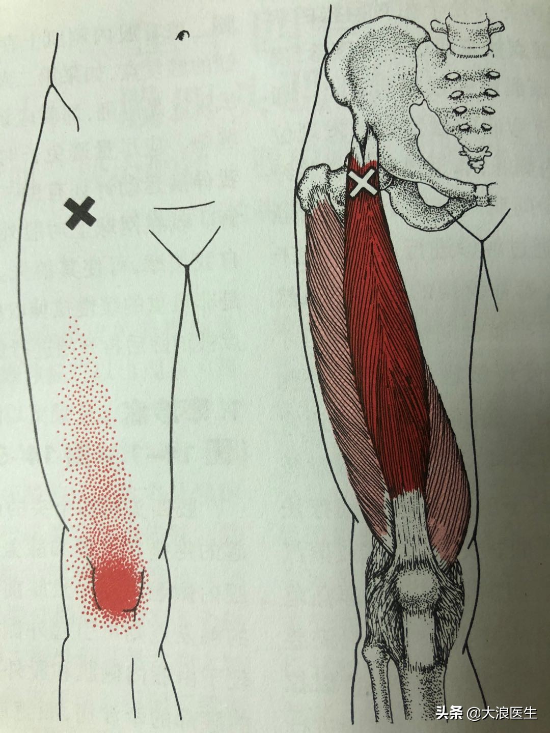 缓解膝关节僵硬锻炼方法,膝关节站立时僵硬休息缓解怎么治