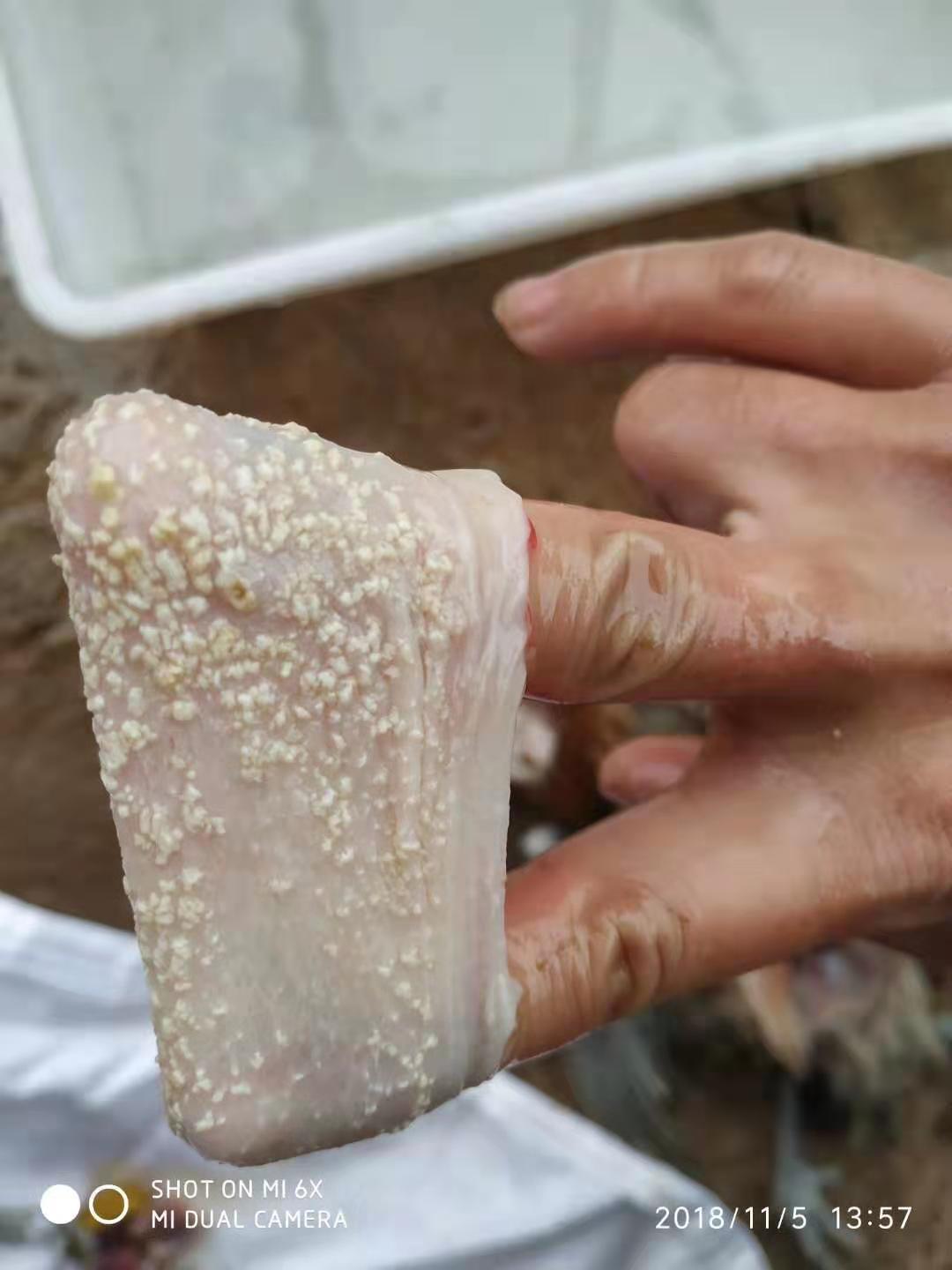 霉菌性炎症治疗经验,霉菌感染怎么治疗医问医答