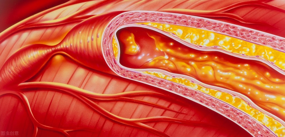 脑袋血管供血不足怎么办,血太浓血管堵