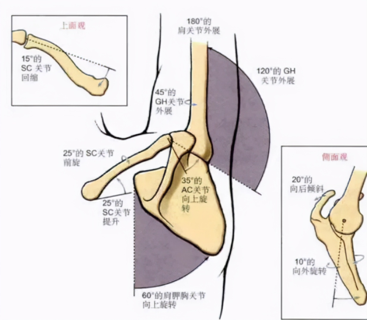 肩峰撞击肩关节疼痛怎么恢复,肩关节疼痛有可能是什么病