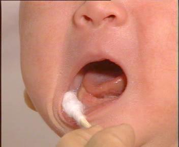 预防传染病的科普宣教,预防感染的科普小视频