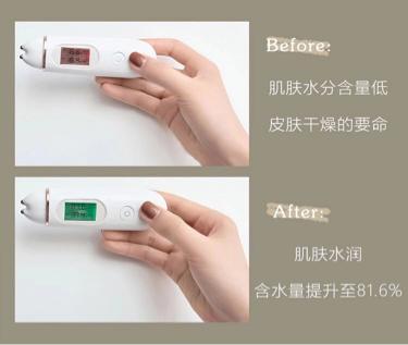 小黑瓶值得买吗,明星代言的小黑瓶