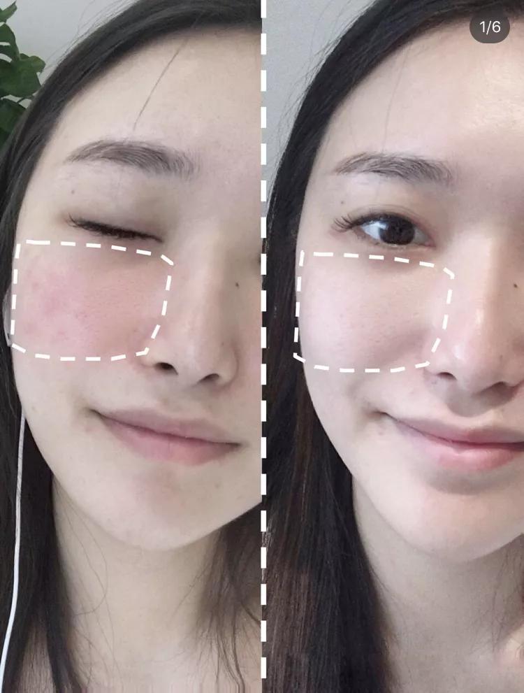 去螨虫慕斯推荐,洗面奶慕斯去螨虫