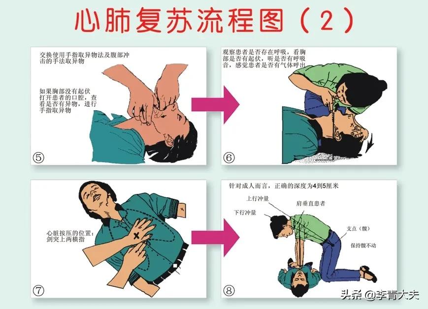 一场教科书式的救援视频,欧洲杯足球赛场抢救