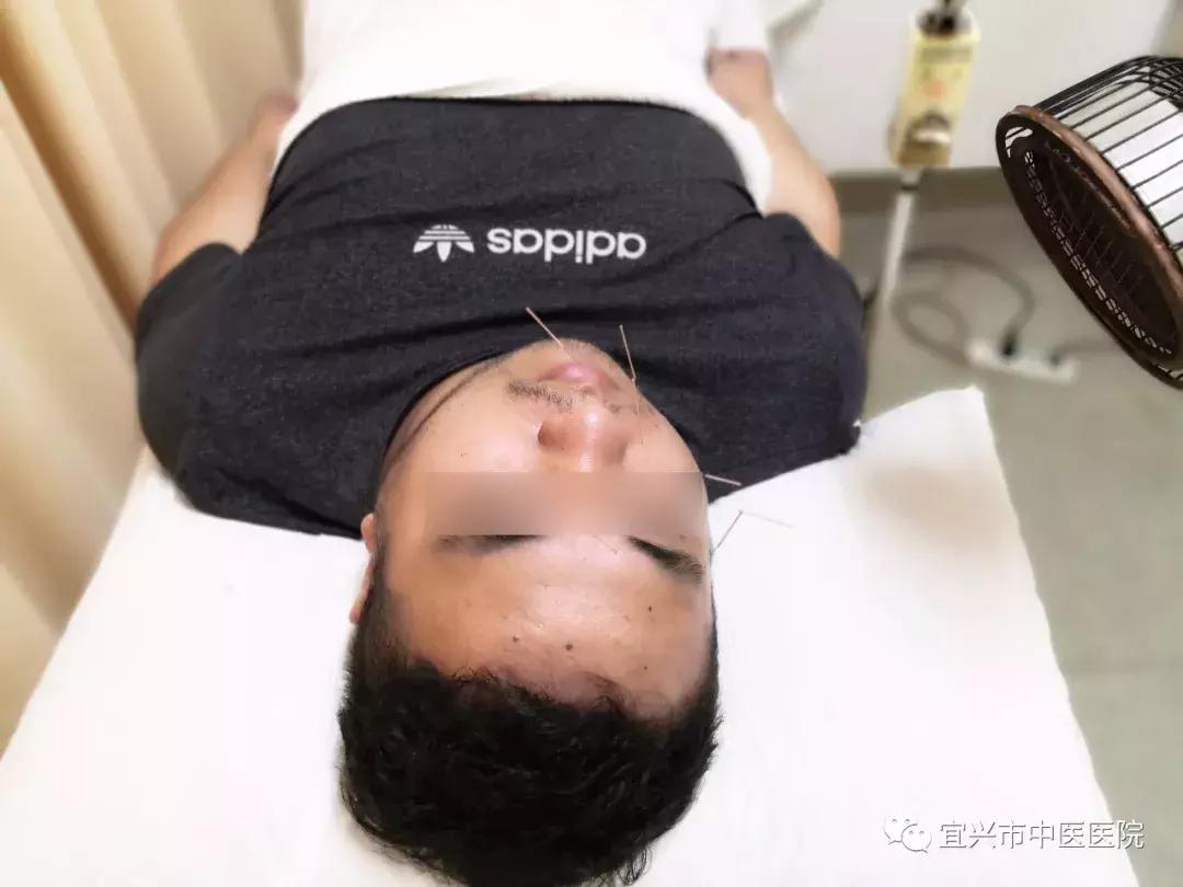 宜兴中医院有治疗面瘫的专家吗,宜兴哪里治面瘫好