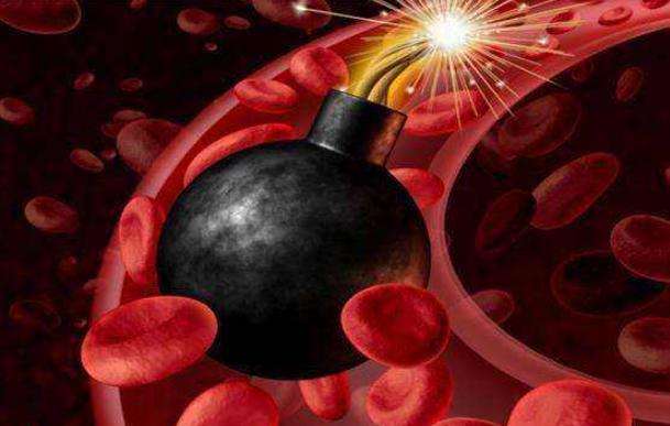 同型半胱氨酸高会影响脑血管病吗 (缺血性脑血管病高同型半胱氨酸)